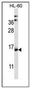 NADH:Ubiquinone Oxidoreductase Complex Assembly Factor 4 antibody, AP52839PU-N, Origene, Western Blot image 