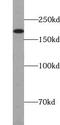 Terminal Uridylyl Transferase 4 antibody, FNab09610, FineTest, Western Blot image 