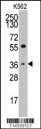 Thrombopoietin antibody, 62-987, ProSci, Western Blot image 