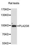 Phospholipase A2 Group VI antibody, STJ111721, St John