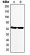 Monoamine Oxidase A antibody, orb214223, Biorbyt, Western Blot image 