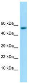 Interferon Induced Protein With Tetratricopeptide Repeats 1 antibody, TA343162, Origene, Western Blot image 