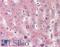 Cytochrome P450 Family 2 Subfamily E Member 1 antibody, LS-B1824, Lifespan Biosciences, Immunohistochemistry paraffin image 