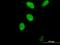Forkhead Box M1 antibody, H00002305-M05, Novus Biologicals, Immunocytochemistry image 