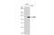 Poly(ADP-Ribose) Polymerase 1 antibody, GTX100573, GeneTex, Western Blot image 