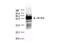 SARS CoV Nucleoprotein antibody, AT004, Boster Biological Technology, Western Blot image 