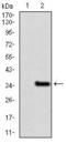 Nuclear Receptor Subfamily 6 Group A Member 1 antibody, GTX60623, GeneTex, Western Blot image 