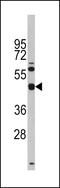 TGFB Induced Factor Homeobox 1 antibody, 62-791, ProSci, Western Blot image 