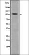 Receptor Tyrosine Kinase Like Orphan Receptor 2 antibody, orb336914, Biorbyt, Western Blot image 