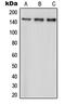 Par-3 Family Cell Polarity Regulator antibody, LS-B14559, Lifespan Biosciences, Western Blot image 