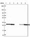 Tumor Protein D52 antibody, NBP2-38952, Novus Biologicals, Western Blot image 