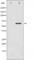 Calcium/Calmodulin Dependent Protein Kinase IV antibody, abx011683, Abbexa, Western Blot image 