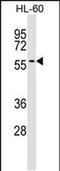 Interferon Related Developmental Regulator 2 antibody, PA5-48833, Invitrogen Antibodies, Western Blot image 