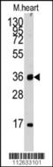 Unc-51 Like Kinase 3 antibody, MBS9207520, MyBioSource, Western Blot image 