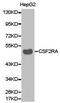 Colony Stimulating Factor 2 Receptor Alpha Subunit antibody, PA5-37358, Invitrogen Antibodies, Western Blot image 