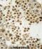 Parkin RBR E3 Ubiquitin Protein Ligase antibody, abx032821, Abbexa, Immunohistochemistry paraffin image 