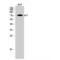 Tumor Protein P73 antibody, LS-C385344, Lifespan Biosciences, Western Blot image 