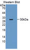 TNF Receptor Associated Factor 6 antibody, LS-C374895, Lifespan Biosciences, Western Blot image 
