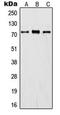 Inter-Alpha-Trypsin Inhibitor Heavy Chain 1 antibody, MBS820776, MyBioSource, Western Blot image 
