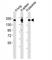Mannose Receptor C-Type 1 antibody, F40105-0.4ML, NSJ Bioreagents, Western Blot image 