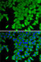 Cellular Retinoic Acid Binding Protein 2 antibody, 22-012, ProSci, Immunofluorescence image 