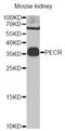 Peroxisomal Trans-2-Enoyl-CoA Reductase antibody, STJ29286, St John