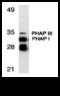 Acidic Nuclear Phosphoprotein 32 Family Member A antibody, 11090, QED Bioscience, Western Blot image 