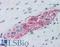 Ribosomal Protein S6 Kinase B1 antibody, LS-B6145, Lifespan Biosciences, Immunohistochemistry paraffin image 