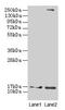 Cellular retinoic acid-binding protein 1 antibody, CSB-PA005935DA01HU, Cusabio, Western Blot image 