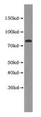 Periostin antibody, MBS2527259, MyBioSource, Western Blot image 
