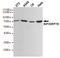 Heat Shock Protein Family A (Hsp70) Member 5 antibody, STJ99068, St John