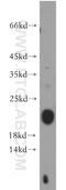 Nucleoside-Triphosphatase, Cancer-Related antibody, 21463-1-AP, Proteintech Group, Western Blot image 