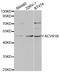 Activin A Receptor Type 1B antibody, A5453, ABclonal Technology, Western Blot image 