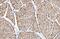 Calcium Voltage-Gated Channel Subunit Alpha1 S antibody, A03006-1, Boster Biological Technology, Immunohistochemistry paraffin image 