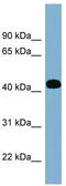 Inositol-Tetrakisphosphate 1-Kinase antibody, TA334503, Origene, Western Blot image 