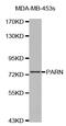 Poly(A)-Specific Ribonuclease antibody, MBS129013, MyBioSource, Western Blot image 