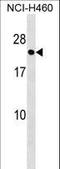 RAB41, Member RAS Oncogene Family antibody, LS-C162386, Lifespan Biosciences, Western Blot image 