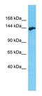 Apoptosis Associated Tyrosine Kinase antibody, GTX16550, GeneTex, Western Blot image 