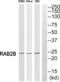RAB2B, Member RAS Oncogene Family antibody, abx014794, Abbexa, Western Blot image 