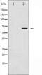 Checkpoint Kinase 2 antibody, abx010985, Abbexa, Western Blot image 