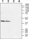 LPA4 antibody, PA5-77479, Invitrogen Antibodies, Western Blot image 