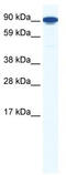 Zinc finger Y-chromosomal protein 1 antibody, TA341828, Origene, Western Blot image 