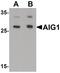 Androgen Induced 1 antibody, PA5-34354, Invitrogen Antibodies, Western Blot image 