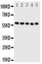 Protein Disulfide Isomerase Family A Member 3 antibody, PA1679, Boster Biological Technology, Western Blot image 