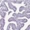 Nucleolar Protein Interacting With The FHA Domain Of MKI67 antibody, NBP2-48642, Novus Biologicals, Immunohistochemistry frozen image 