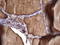 Thyroglobulin antibody, LS-C339107, Lifespan Biosciences, Immunohistochemistry frozen image 