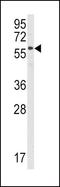 Signal Transducing Adaptor Molecule antibody, PA5-12087, Invitrogen Antibodies, Western Blot image 