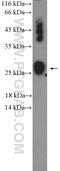 NADH:Ubiquinone Oxidoreductase Core Subunit S8 antibody, 25172-1-AP, Proteintech Group, Western Blot image 