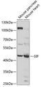 Cobalamin Binding Intrinsic Factor antibody, A00038, Boster Biological Technology, Western Blot image 