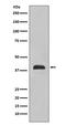 NK2 Homeobox 1 antibody, M01322-1, Boster Biological Technology, Western Blot image 